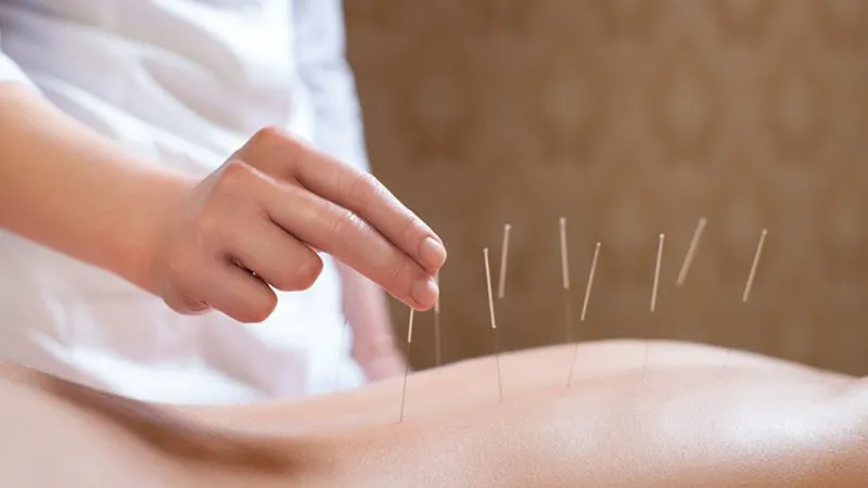 beneficios acupuntura para tratar cancer joao pessoa pb
